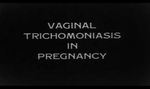 Vaginal Trichomoniasis in Pregnancy by Pascal Brooke Bland, Leopold Goldstein, and David H. Wenrich