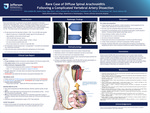 Rare Case of Diffuse Spinal Arachnoiditis Following a Complicated Vertebral Artery Dissection by Elias Atallah, MD; Sophia Dang; Sage Rahm; Nohra Chalouhi, MD; Stavropoula Tjoumakaris MD; Robert H. Rosenwasswer MD; and Pascal Jabbour MD