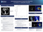 Automated Assessment of Acute Aortic Dissection on Thoracic CT Using Deep Learning by Varun Singh; Richard Gorniak, MD; Adam Flanders, MD; and Paras Lakhani, MD