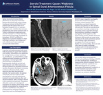 Steroid Treatment Causes Weakness in Spinal Dural Arteriovenous Fistula