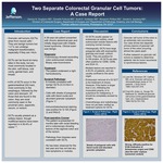 Two Separate Colorectal Granular Cell Tumors: A Case Report by Danica N. Giugliano, MD; Danielle Fortuna, MD; Scott D. Goldstein, MD; Benjamin Philllips, MD; and Gerald A. Isenberg, MD